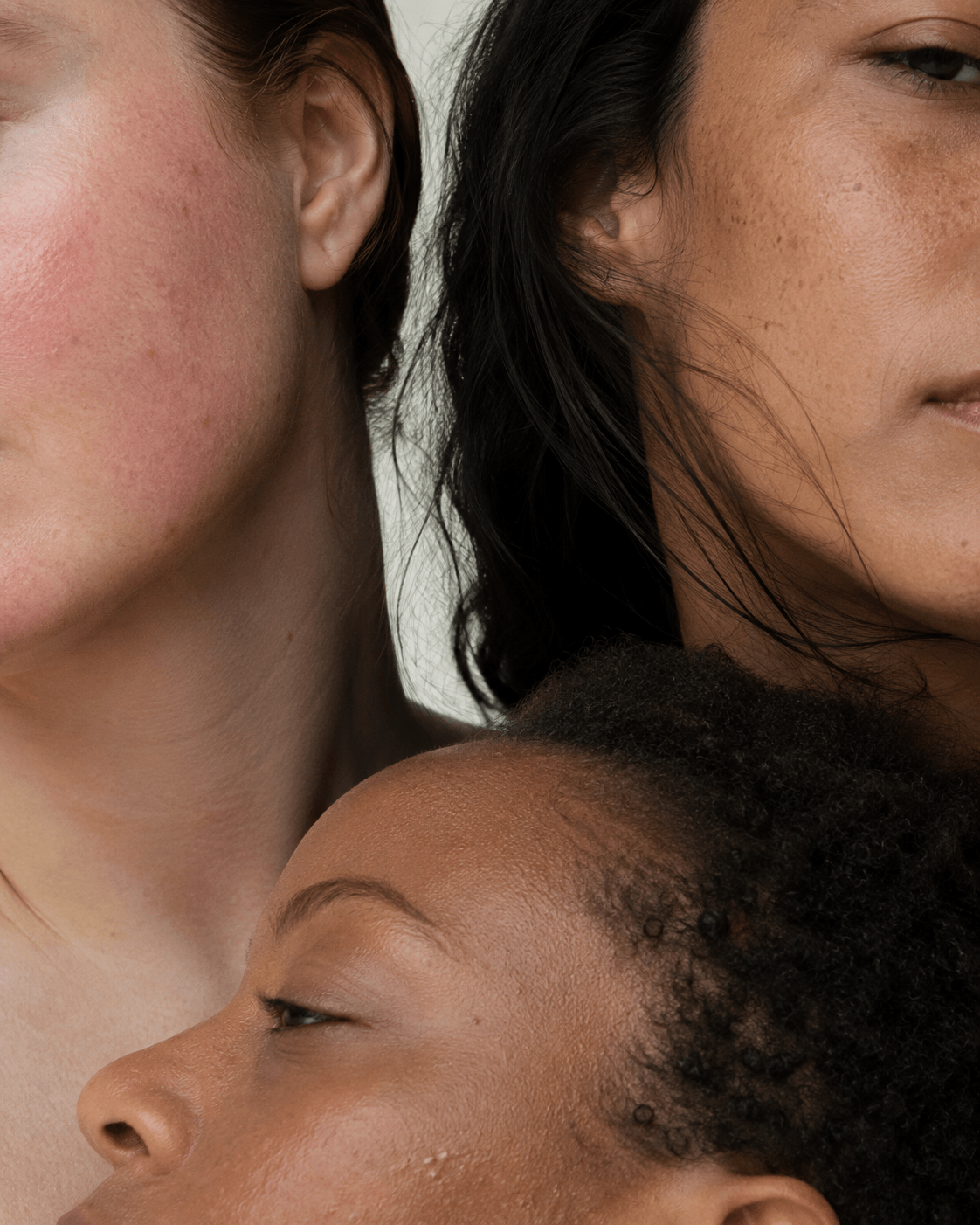 Skin Conditions Aren't One-Size-Fits-All
